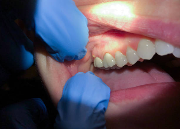 Best Cracked Tooth Emergency Dentist  in Blawnox, PA